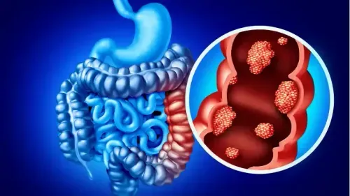 What Causes Issues with the Ascending Colon?
